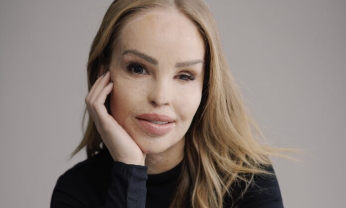 Katie Piper ex boyfriend news